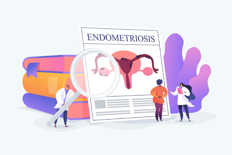 Stylised fact sheet on endometriosis with figures discussing it (Getty images)