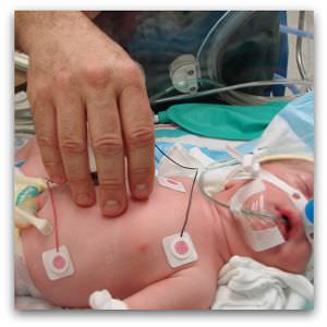 Flickr image 'Grandson number 2 in neonatal intensive care unit, with his father's hand', by Martin LaBar