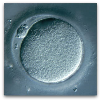 Human egg cell, Flickr image by remolacha.net fotos